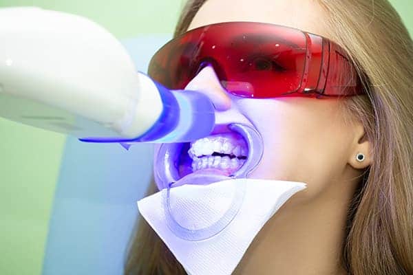 Laser teeth whitening treatments Cambridge