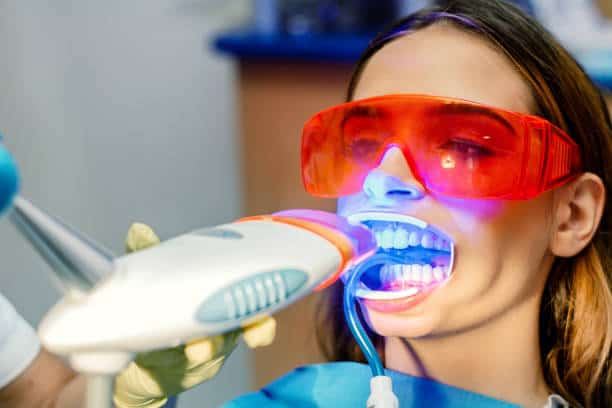 Simplifying Teeth Whitening: A Comprehensive Guide Cambridge