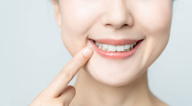 Comparing the Pain Factor: Laser Teeth Whitening vs. Zoom Teeth Whitening Cambridge