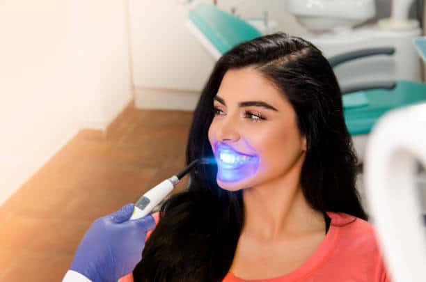 Top Teeth Whitening Systems for a Brighter Smile Cambridge