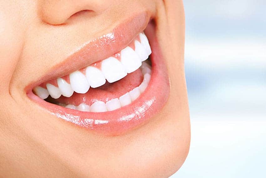 Teeth Whitening Abingdon Cambridge