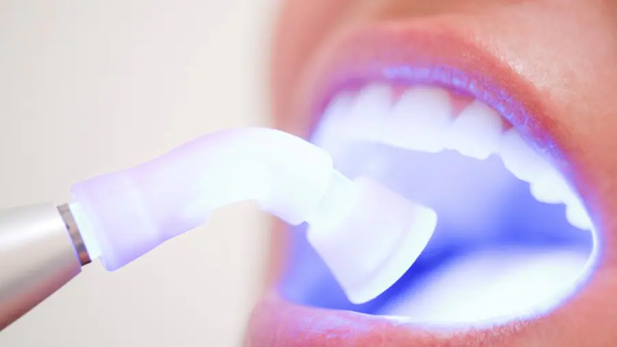 Teeth Whitening Aylesbury Cambridge